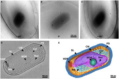 Ultrastructural insights into cellular organization, energy storage and ribosomal dynamics of an ammonia-oxidizing archaeon from oligotrophic oceans